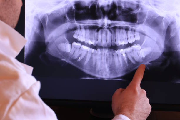 Best Mobile Emergency Dentist in Lus Valley Marinwood, CA