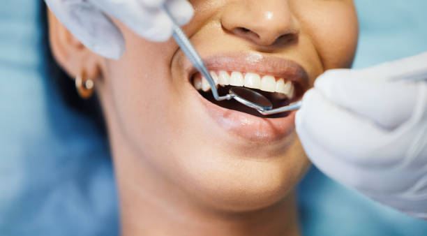 Best Orthodontic Emergency Dentist in Lus Valley Marinwood, CA