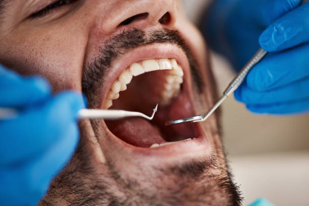 Best Pediatric Emergency Dentist in Lus Valley Marinwood, CA