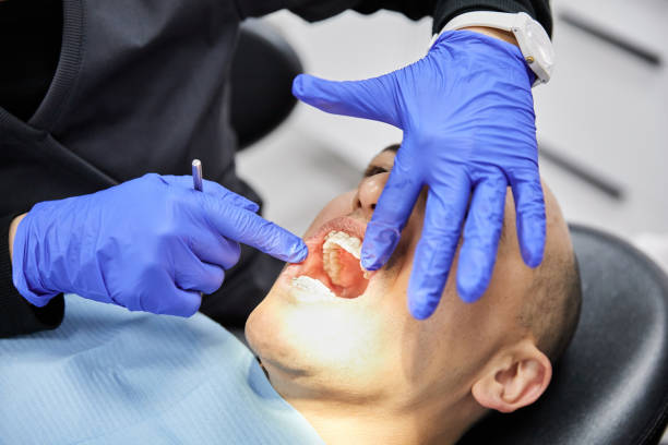 Best Emergency Dentist for Knocked-Out Tooth in Lus Valley Marinwood, CA